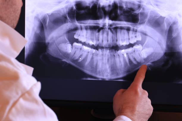 Best Emergency Root Canal Treatment in Justice, OK