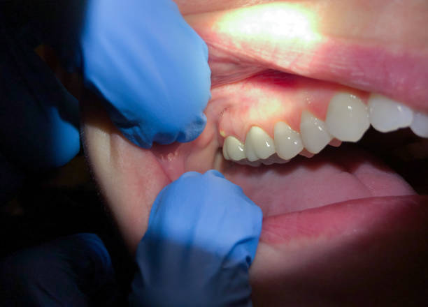 Best After-Hours Emergency Dentist in Justice, OK