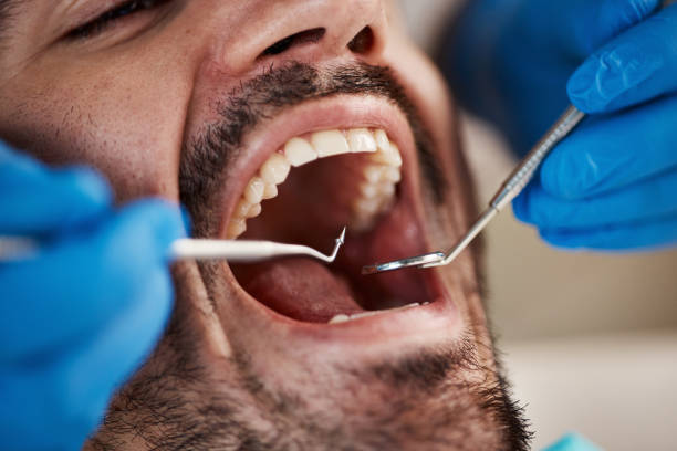 Best Emergency Broken Tooth Repair in Justice, OK